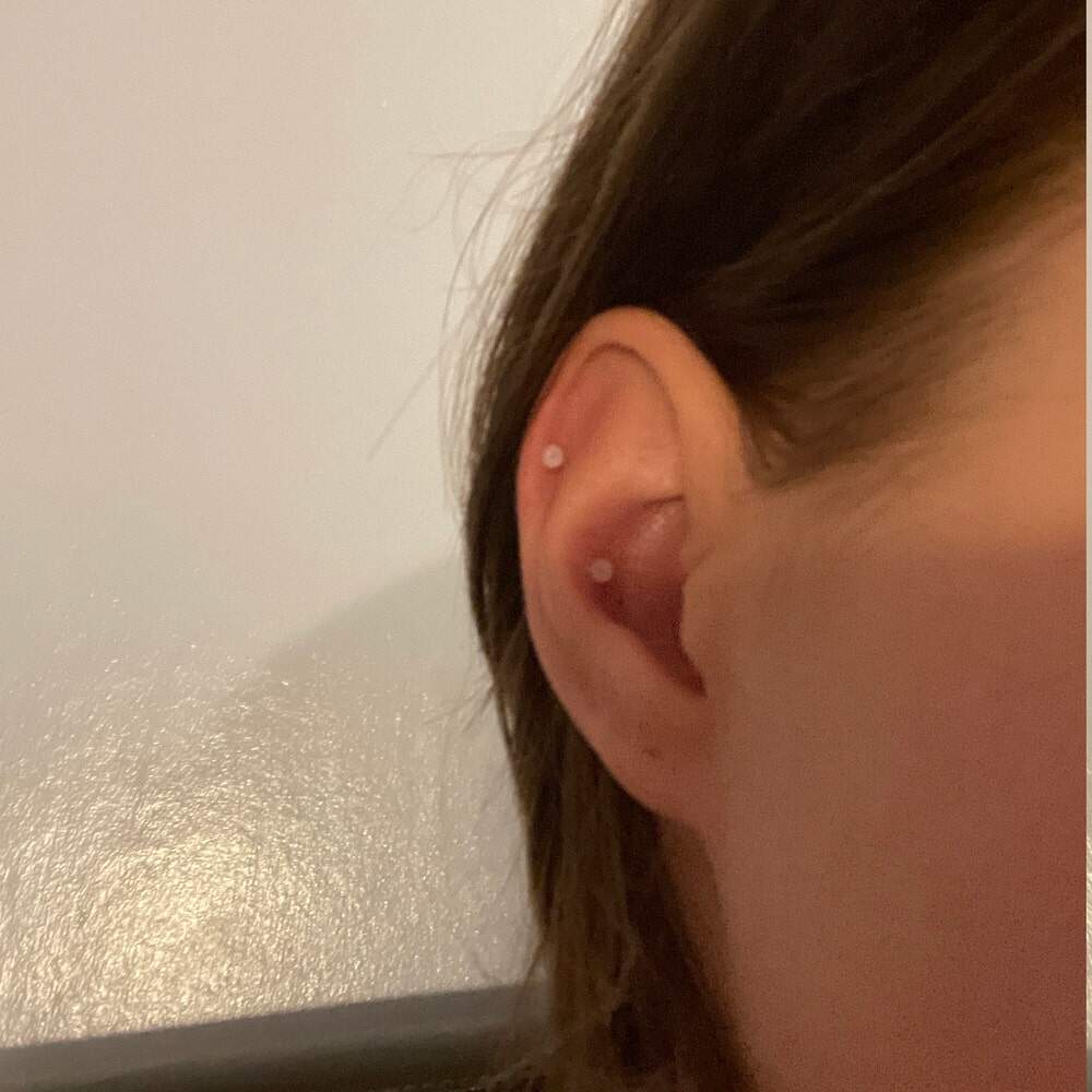 SILICONE FLATBACK RETAINER