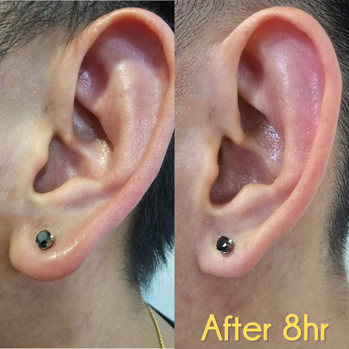 Lightning Quick Healing Piercing Aftecare
